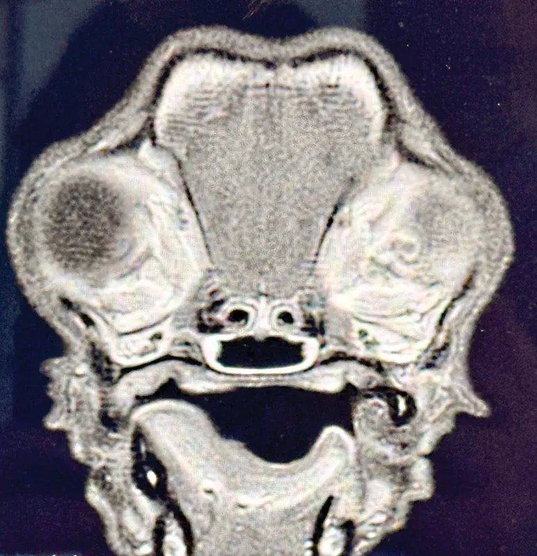 Unraveling the Enigma of Canine Autoimmune Myopathy: The Complex Case of Rigby the Cavalier King Charles Spaniel